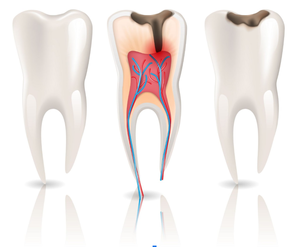 杜牙根 - 臻善牙科 Artisan Dental